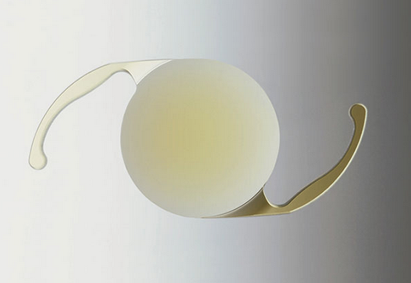 Cataract surgery.png