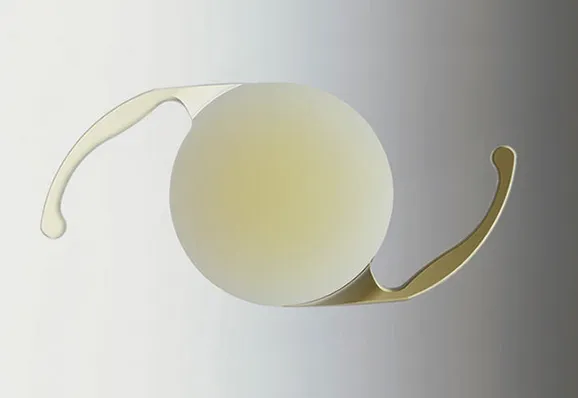 Cataract surgery.png